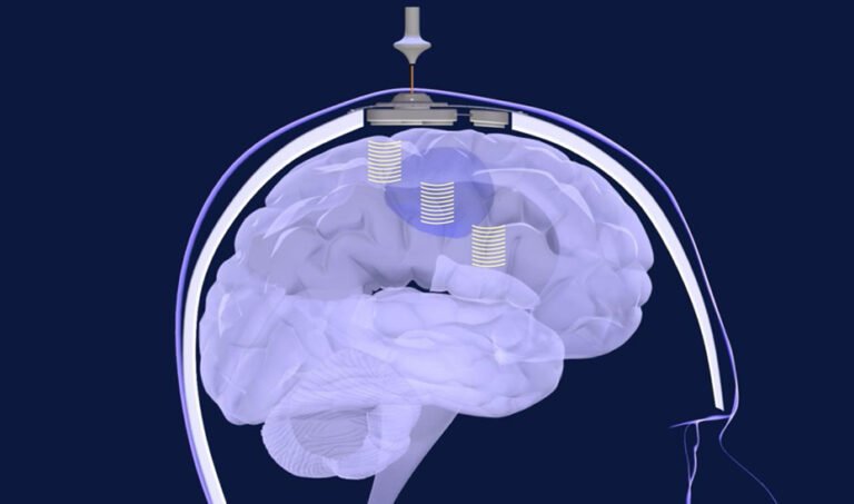 Andalucia-participa-en-estudio-pionero-contra-el-glioblastoma.jpg