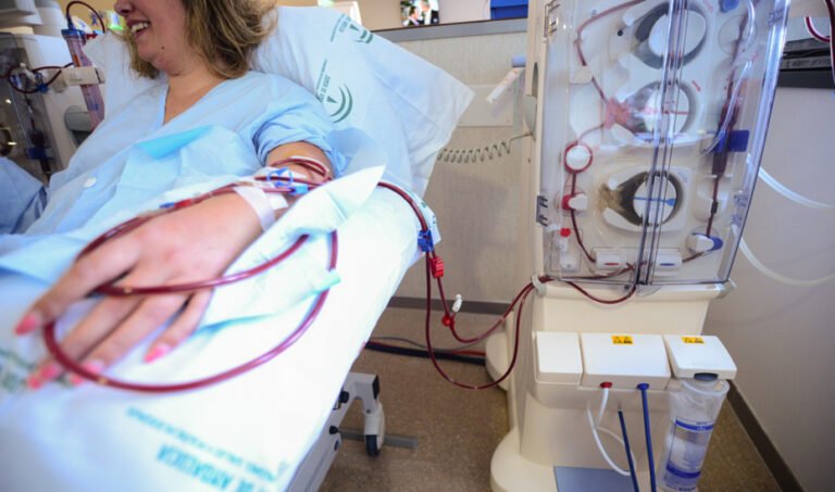 La hemodiálisis es un procedimiento esencial para la supervivencia de personas con insuficiencia renal.